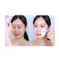 BIOHEAL BOH - Probioderm Melting Collagen Deep Shot Nasolabial Folds & Cheek Film Set